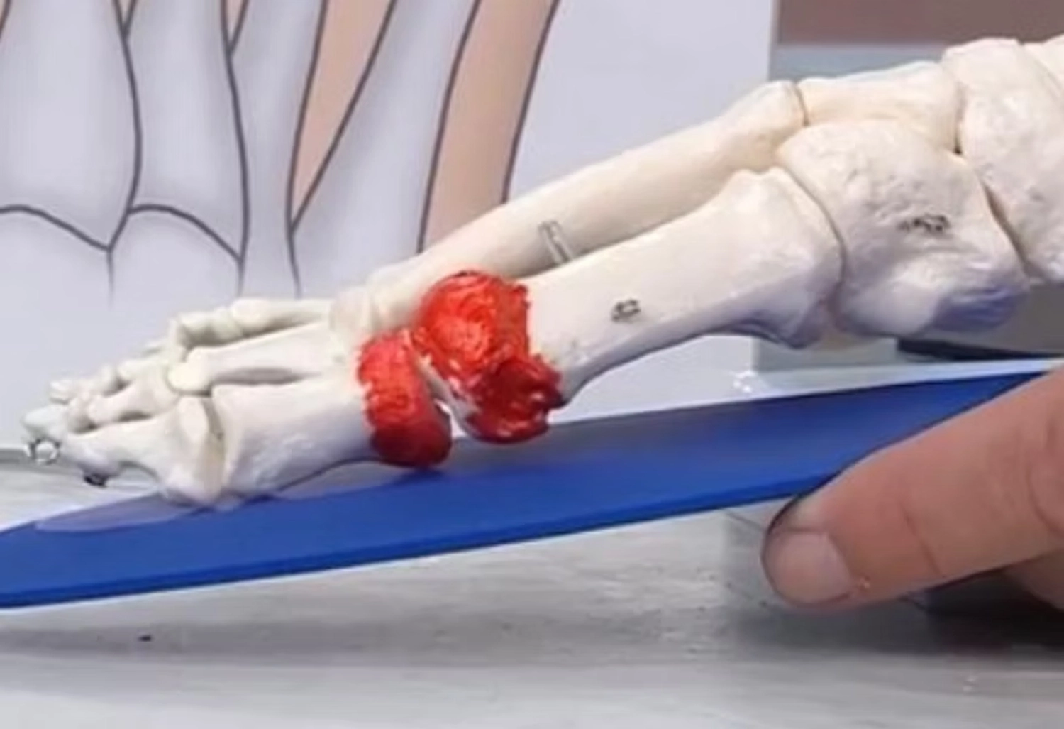 Hans-Peter Mielke – Vertrieb von Hallux Einlegesohlen – gehende Menschen